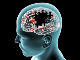 Neuroprotective effects