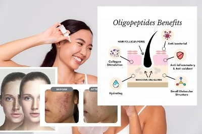 Is Oligopeptide-54 good for the skin Is Oligopeptide-54 good for the skin